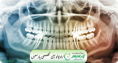 رادیوگرافی پانورکس