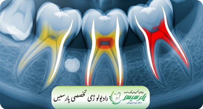 رادیوگرافی بایت وینگ