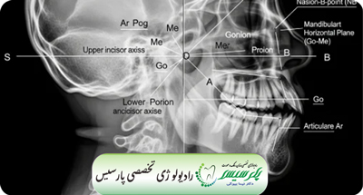 رادیوگرافی سفالومتری