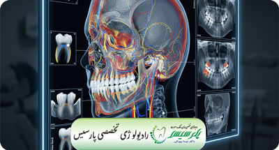 CBCT