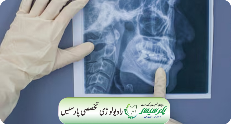 سفالومتری در تشخیص ناهنجاری‌های فک و صورت: راهنمای جامع