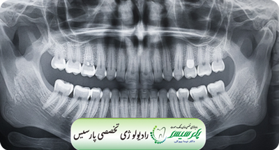 عکس رادیولوژی دندان عقل چه زمانی لازم است؟ | پانورکس و CBCT | دکتر نیما بیوکی | قم